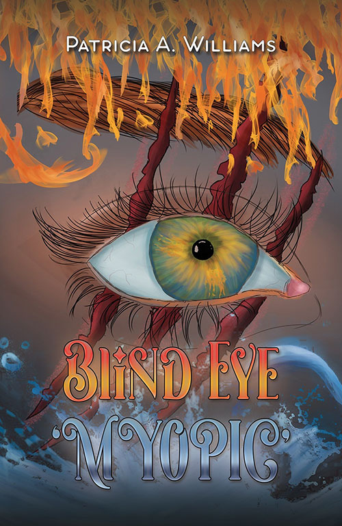  Blind Eye myopic