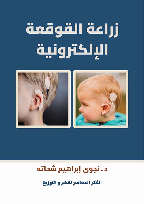 زراعة القوقعة الإلكترونية