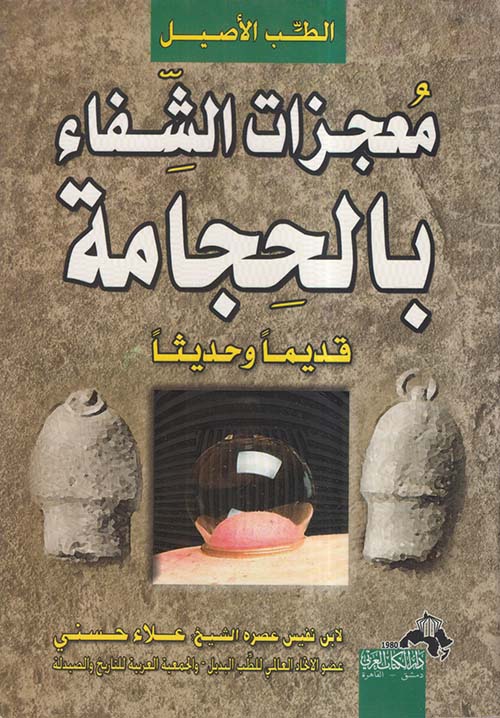 معجزات الشفاء بالحجامة قديماً وحديثاً