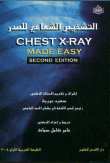 التشخيص الشعاعي للصدر CHEST X - RAY MADE EASY
