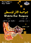 جراحة الأذن الوسطى