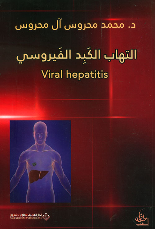 التهاب الكبد الفيروسي