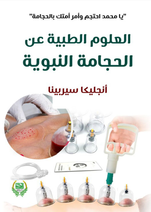 العلوم الطبية عن الحجامة النبوية
