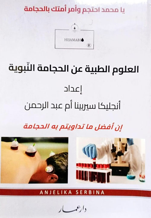 العلوم الطبية عن الحجامة النبوية