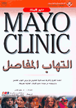 Mayo Clinic التهاب المفاصل